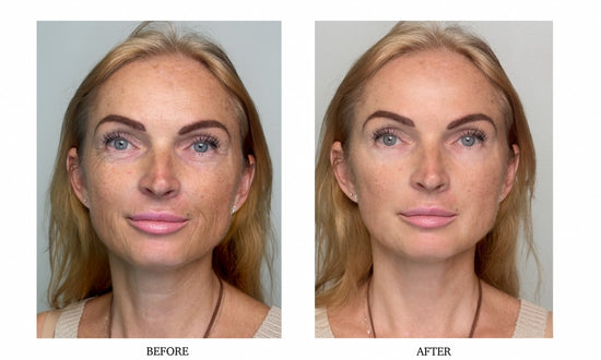 Customer using Instant Firming Face Tightener