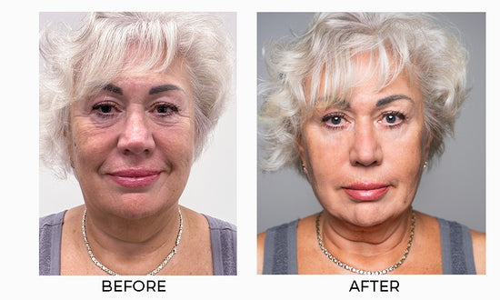 Customer using Instant Firming Face Tightener
