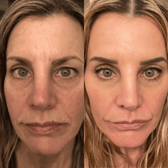 Customer using Instant Firming Face Tightener