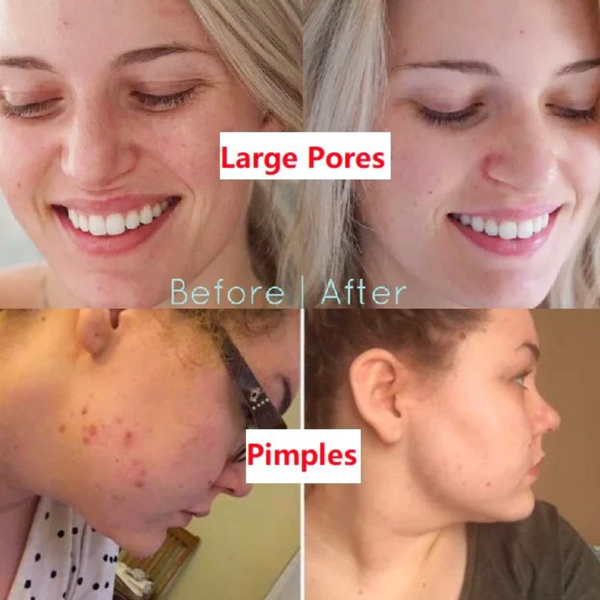 LOVILDS™ Green Tea Deep Cleanse Mask Stick – Pore Minimizing Blackhead Remover with Natural Green Tea Extract, Oil Control & Gentle Cleansing for All Skin Types